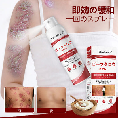 🥇CleraNaure® ビーフタロウスプレー — かゆみ・皮膚の剥がれを抑える乾癬用スキンケアスプレー🥇