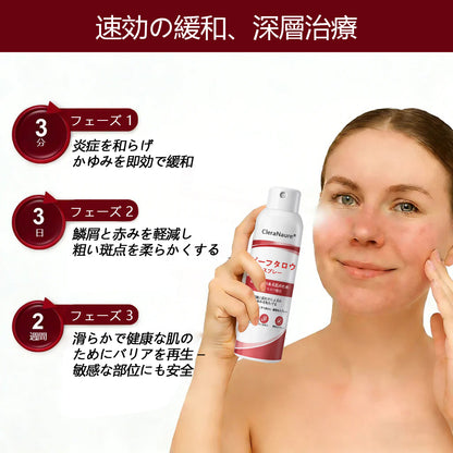 🥇CleraNaure® ビーフタロウスプレー — かゆみ・皮膚の剥がれを抑える乾癬用スキンケアスプレー🥇