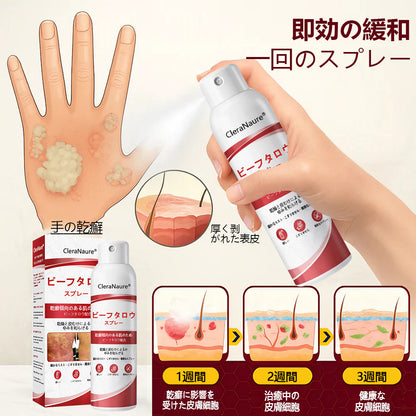 🥇CleraNaure® ビーフタロウスプレー — かゆみ・皮膚の剥がれを抑える乾癬用スキンケアスプレー🥇